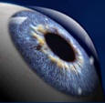 LASIK